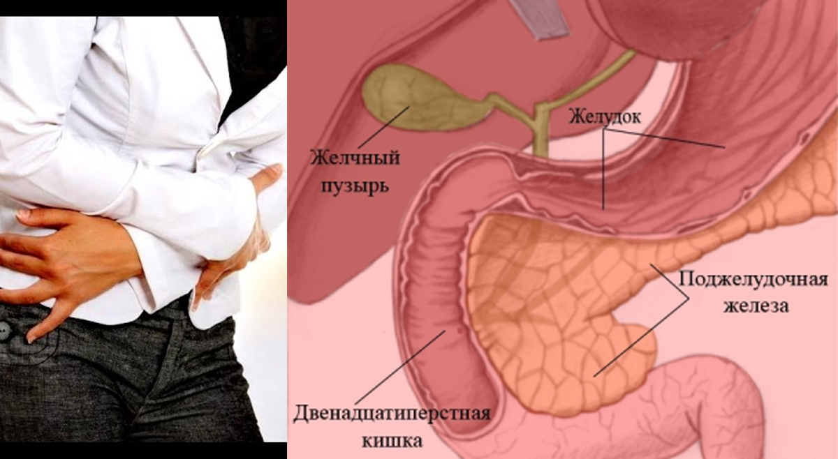 Дискинезия 12 перстной кишки