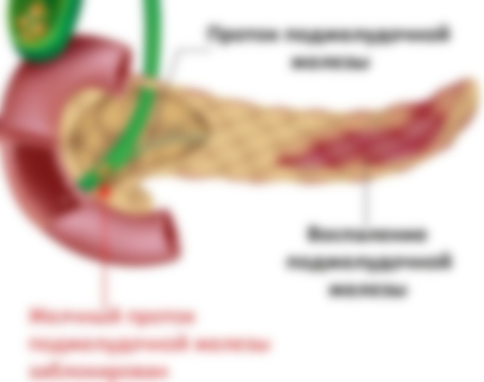 Поджелудочная железа: где находится и как болит